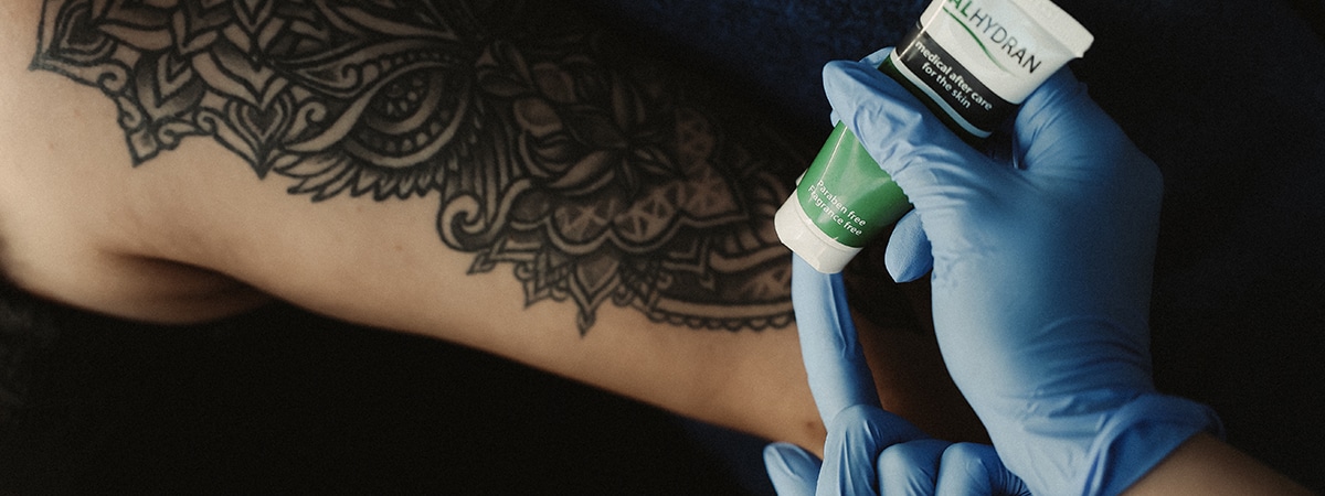 Tattoo verwijderen nazorg